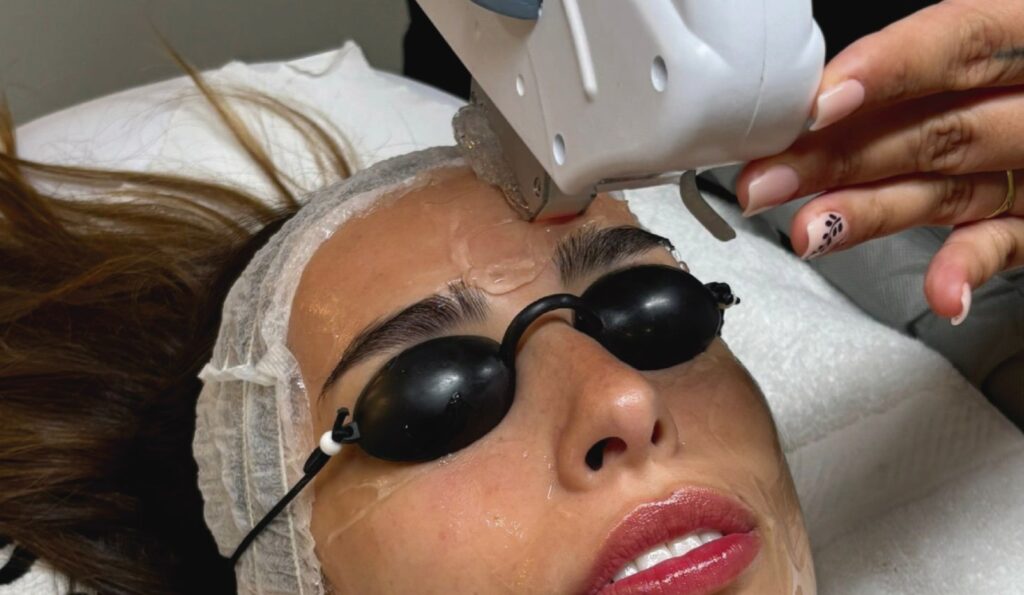 Facial photorejuvenation kyiv